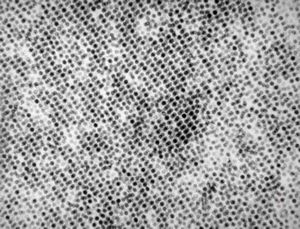 papilomavirus - verruca vulgaris papilomavirus - verruca vulgaris
